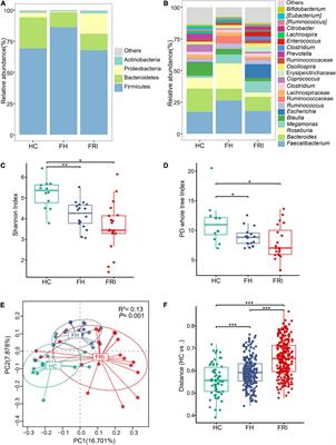 Altered Gut Microbiota as an Auxiliary Diagnostic Indicator for Patients With Fracture-Related Infection